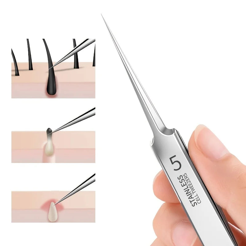 Professional Blackhead Remover Tweezers – Flawless Skin at Home