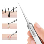Professional Blackhead Remover Tweezers – Flawless Skin at Home