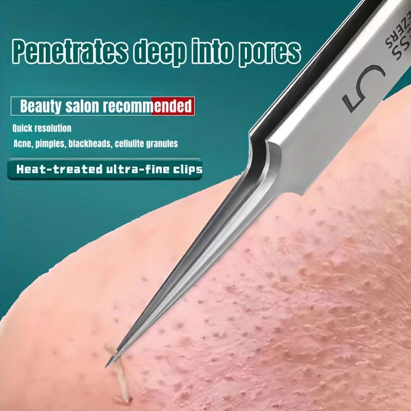 Professional Blackhead Remover Tweezers – Flawless Skin at Home
